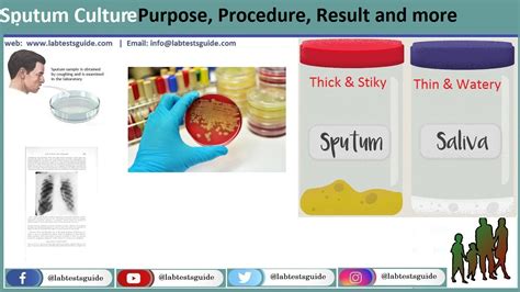 sputum test results how long|Sputum Culture: MedlinePlus Medical Test.